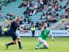 Hibs vs Aston Villa injury latest: 10 key stars out of Europa Conference League clash with 4 doubts - gallery