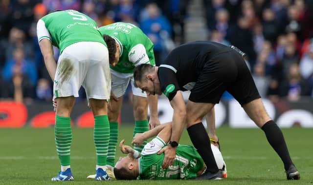 Down but not out - Hibs look to recover after their defeat at Ibrox 
