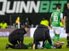 'When you see a stretcher, you know it's serious' - Hibs boss feared worst