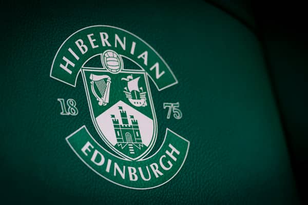 Hibs face Ross County next