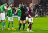 21 cracking Hearts and Hibs derby photos from away end bedlam to Shankland chomping on fan pie - gallery