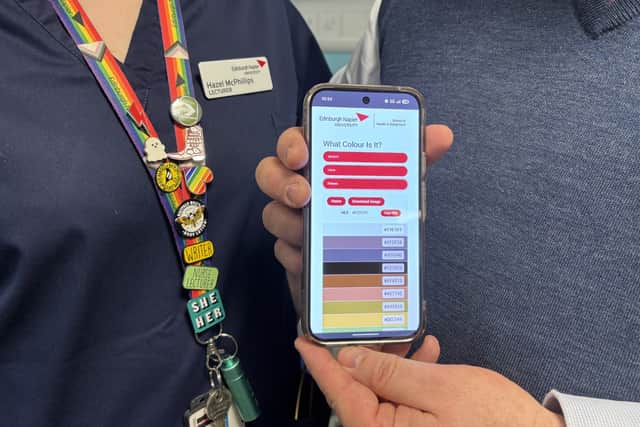 The free online tool resembles a paint colour card, with palettes of either 13 or 15 clinically-relevant colours for identifying the colour of sputum, urine and faeces.