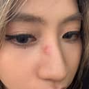 Yumin Chen was punched in nose on Princes Street Gardens on Friday