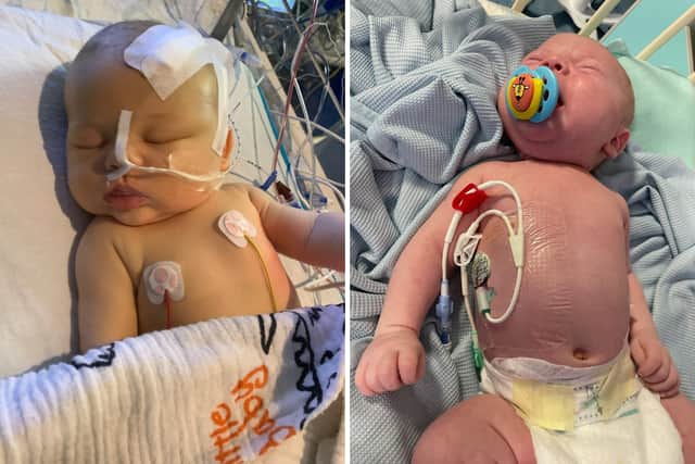 Sam Sharp, 39, gave birth to her baby boy, Joey, in 2020. Just 11 days later, Joey, of Penicuik, Midlothian, was taken to hospital after he struggled to feed, lost weight and developed persistent jaundice.