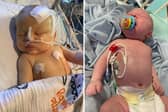 Sam Sharp, 39, gave birth to her baby boy, Joey, in 2020. Just 11 days later, Joey, of Penicuik, Midlothian, was taken to hospital after he struggled to feed, lost weight and developed persistent jaundice.