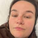 She has been suffering with endometriosis since she was 14 