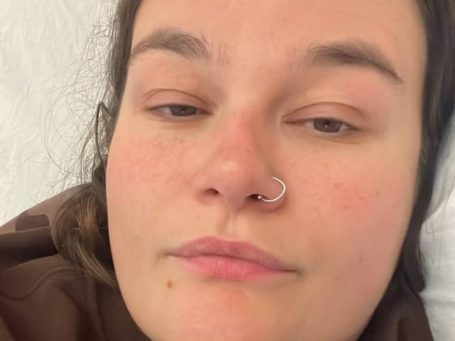 She has been suffering with endometriosis since she was 14 