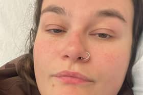 She has been suffering with endometriosis since she was 14 