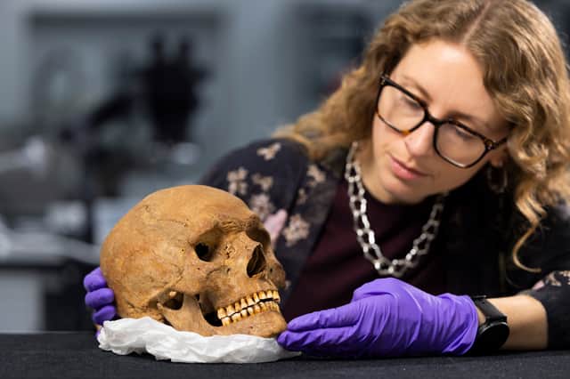Dr Jess Thompson examining the skull of a man from Roman Scotland.
