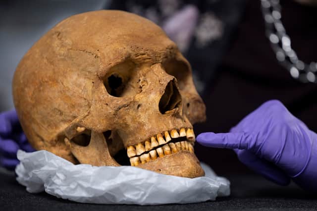 The man's skull will be on display as part of the 'Roman Scotland: Life On The Edge Of Empire' exhibition, which opens next month