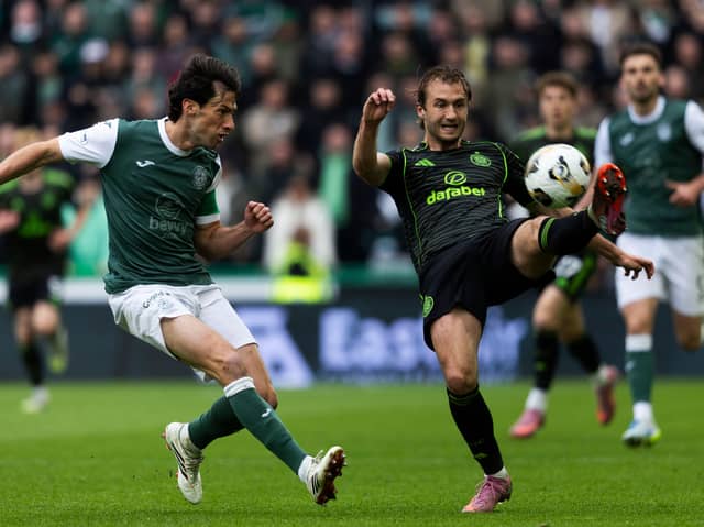 Hibs face Celtic this weekend.