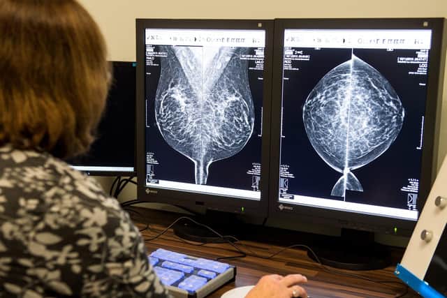 The report showed there had been a slight increase in the cancer detection rate for women who had been screened.