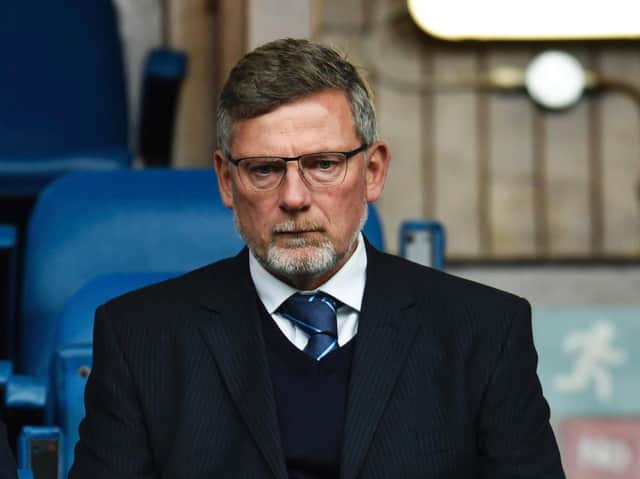 Hearts manager Craig Levein is awaiting the return of injured players