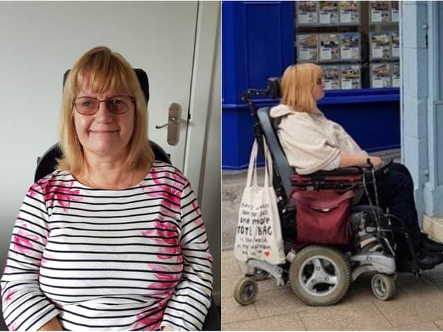 Shirley Todd suffered a stroke on the operating table while having a brain tumour removed and was left partially paralysed.