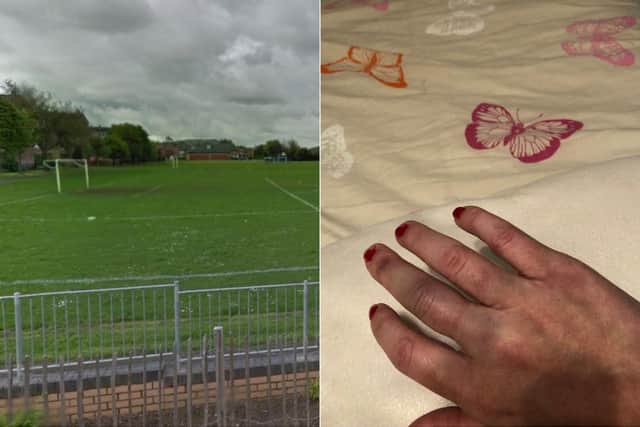 Emily Thompson was left with a bruised and swolen hand after stopping the rogue firework. Pic: Submitted/Google Maps