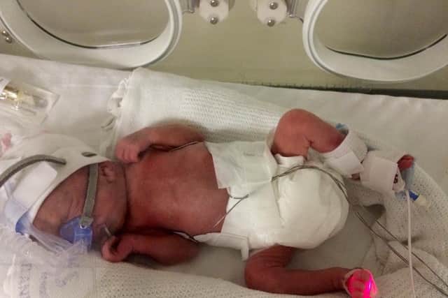 Matthew Dorman was tiny and weighed only two pounds when he was born 11-weeks premature.