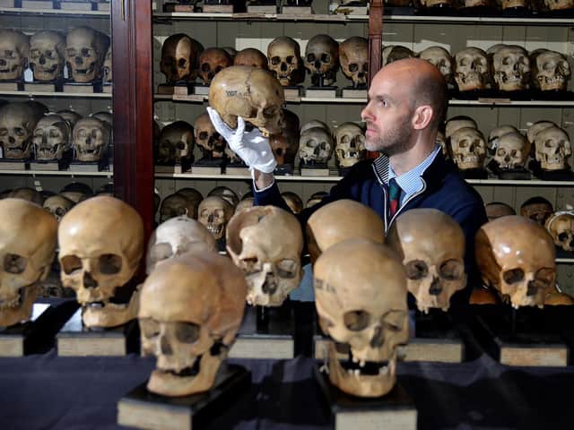 Professor Tom Gillingwater with some aboriginal skulls from the collection.
