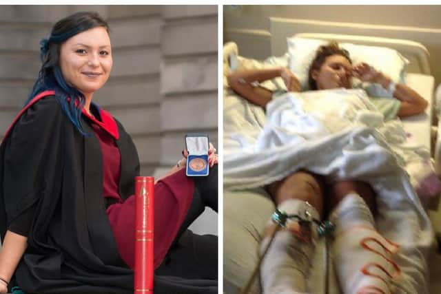 Determined Edinburgh Napier student who lost leg after 60ft tree fell on her at music festival graduates