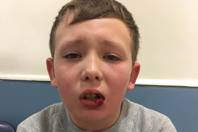 Sonny Murray, 10, was left fearing for his life during the attack (Photo: Lynda Murray)