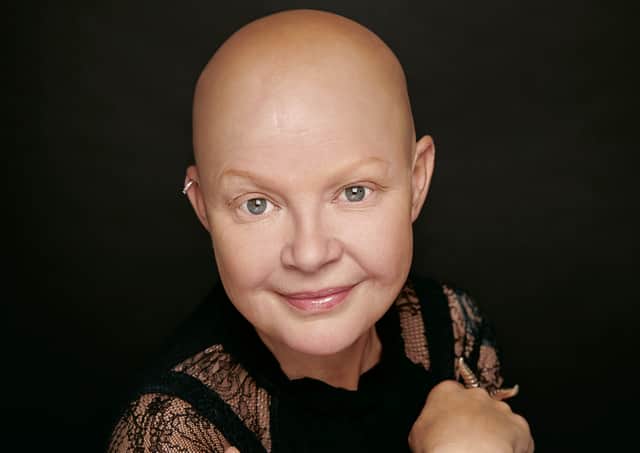 Gail Porter is helping others by sharing her story. Picture: Debra Hurford Brown