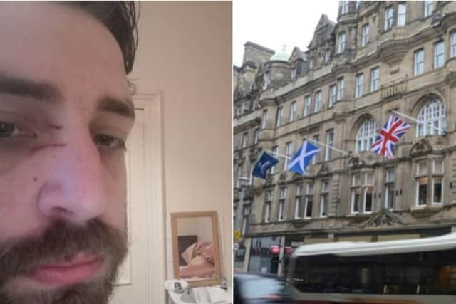 Joh Churton claims he was dragged out of the Carlton Hotel on Edinburgh's North Bridge.