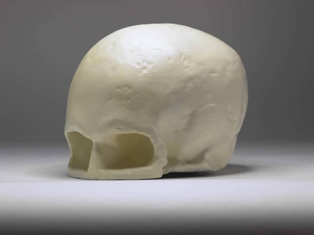 Plaster cast of Robert Burns' skull at Edinburgh's Writers' Museum