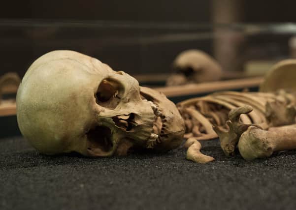 Even a half-finished model skeleton could give you a scare if you weren’t expecting to find it under your bed (Picture: John Devlin)