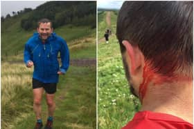 Mr Hartree was attacked by a cow in the Pentland hills on August 22, 2020.