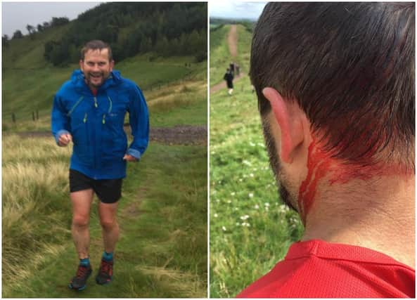 Mr Hartree was attacked by a cow in the Pentland hills on August 22, 2020.