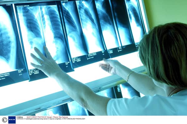 NHS Lothian has spent nearly £7 million outsourcing radiology services over the past five years.  Picture:  Burger / Phanie / Rex Features