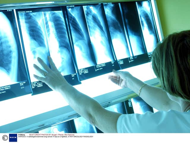 NHS Lothian has spent nearly £7 million outsourcing radiology services over the past five years.  Picture:  Burger / Phanie / Rex Features