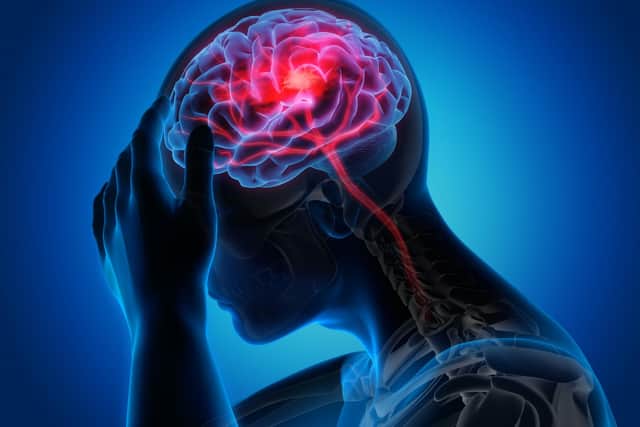 One of the new Covid symptoms is a headache (Shutterstock)