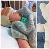 A young boy from Edinburgh who is recovering from brain surgery has lost his teddy in the children's hospital.