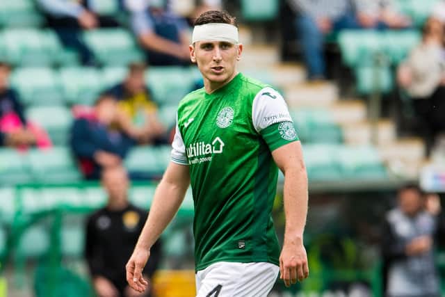 Hibs captain Paul Hanlon had to leave the action early against Ross County due to the head injury sustained against Rijeka. He has also missed out on the return leg in Croatia. Photo by Ross Parker / SNS Group