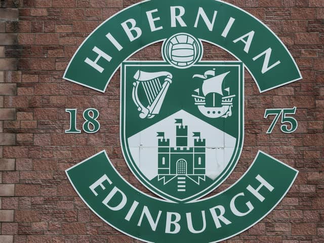 Hibs have two players in the Scotland Under-16 squad