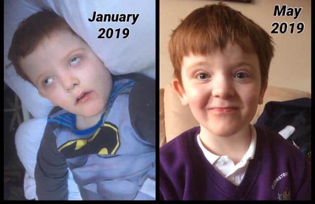 Murray’s standard of life has improved dramatically since receiving cannabis oil. He can: “run about and play like a normal wee boy now,” says mum.