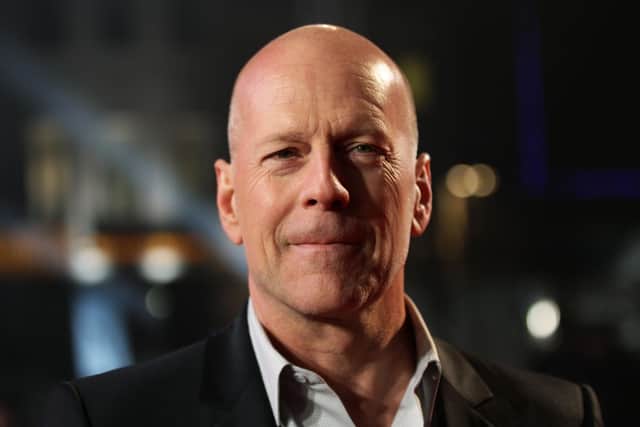 Bruce Willis has announced that he will step back from his acting career after recently been diagnosed with aphasia, a condition which has affected his cognitive abilities. Photo: Yui Mok