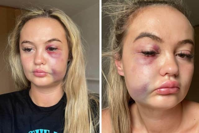 Ellen Clarkson was attacked while at a music concert