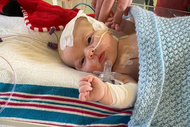Little Joey underwent life-saving surgery when he was just 12 days old.