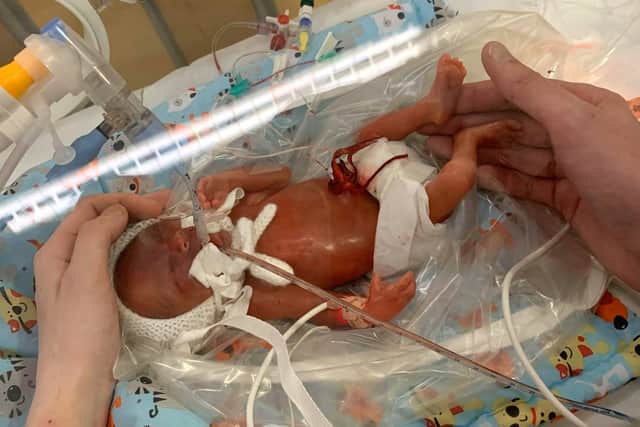 Their son had been rushed straight into the neonatal intensive care unit and placed on a ventilator as soon as he was born as he was so tiny he wasn't able to breathe properly after arriving 13 weeks prematurely - at 22 weeks - on 3rd March 2019 weighing a tiny 1lb.