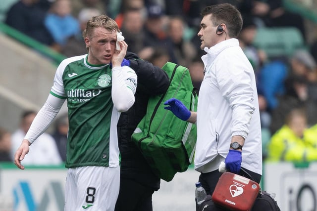 Suspected concussion following a clash of heads during last week's game v St Mirren