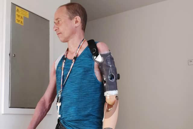 Jim tests out his bionic arm