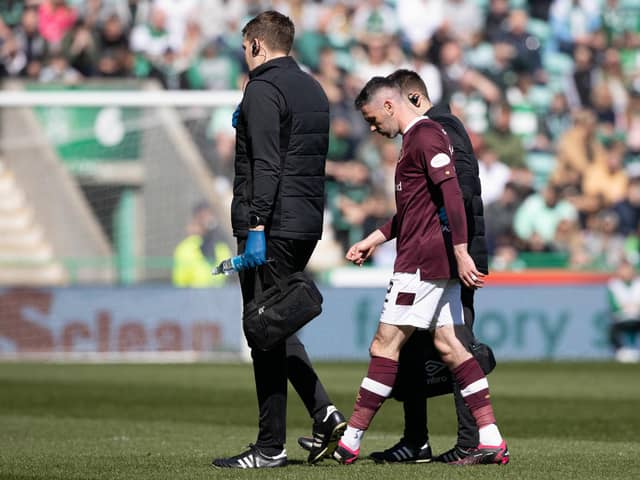 Hearts defender Michael Smith was forced off with an injury against Hibs on Saturday.
