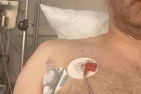 David required a tube to drain fluid from his punctured lung