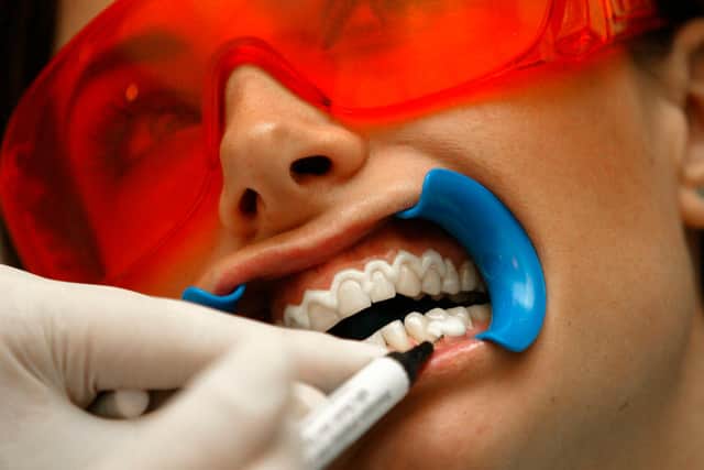 Teeth-whitening procedures can be pricey (Picture: Sion Touhig/Getty Images)