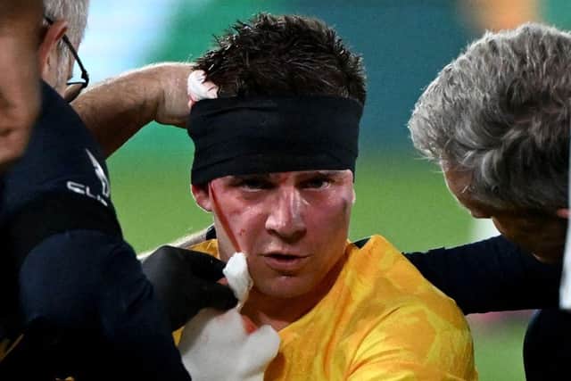 Cammy Devlin receives treatment for his head wound. Picture: Getty