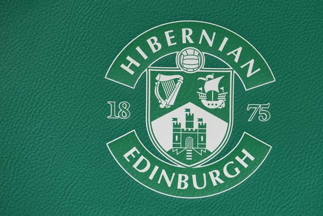 Hibs are surveying fans on a number of issues