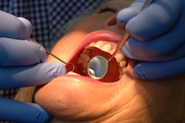 A furious OAP says patients are being ‘discarded’ after dentist stops NHS treatment. Photo: John Giles/PA Wire