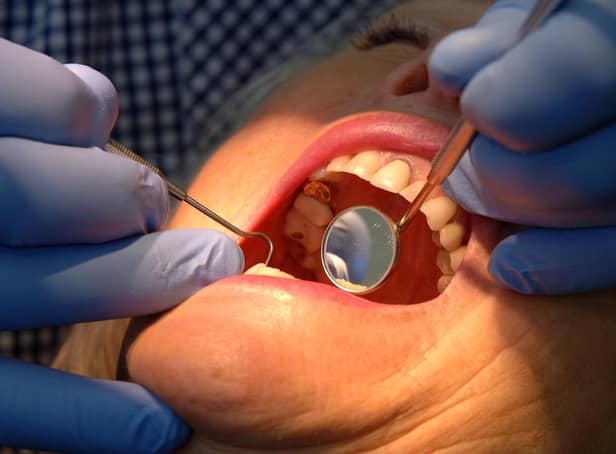 A furious OAP says patients are being ‘discarded’ after dentist stops NHS treatment. Photo: John Giles/PA Wire