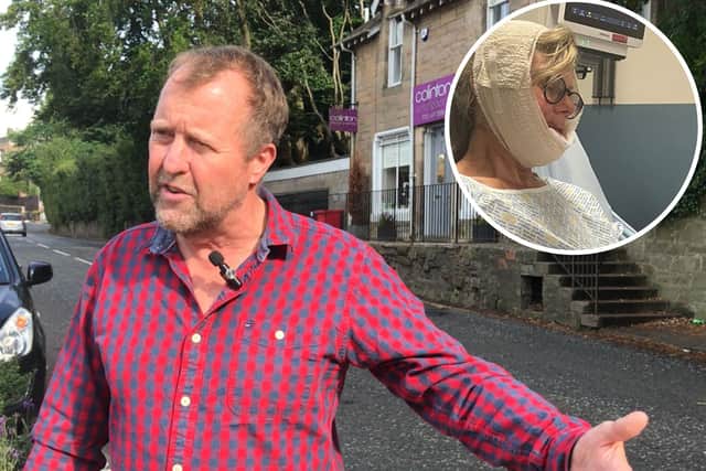 "In my view it is absolutely appalling.” Steve Packwood said he can't understand why the council has not repaired the pothole that caused his wife's accident